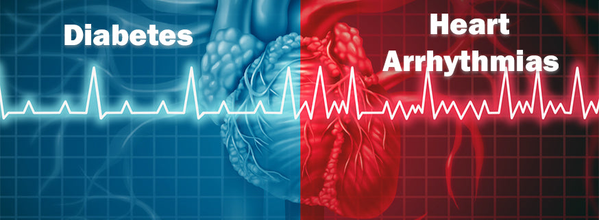 Diabetes and Heart Arrhythmias